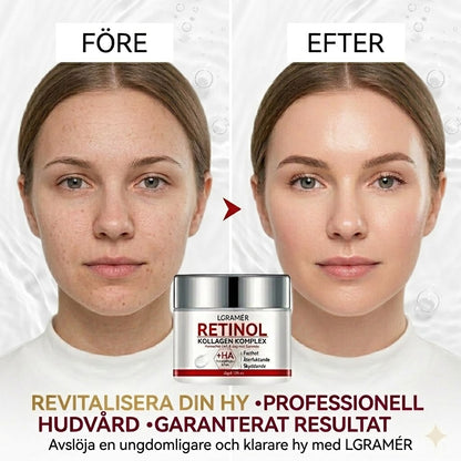 Crème Raffermissante au Rétinol ✨